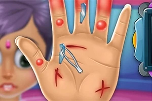 Hand Doctor Bàn tay bị thương với vết xước và mảnh vụn, cùng một đôi nhíp chuẩn bị gắp chúng ra